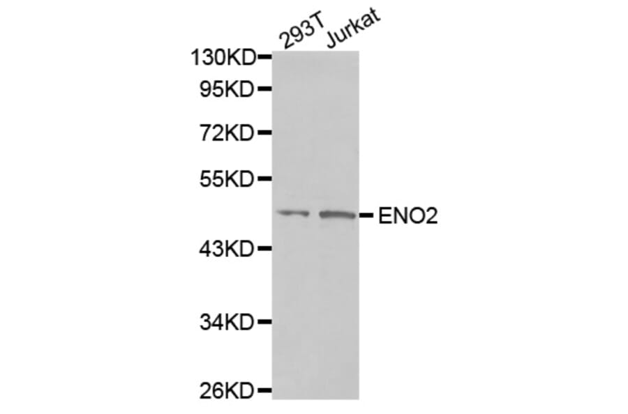 Anti-NSE/Enolase Antibody from Bioworld Technology (BS7180) - Antibodies.com