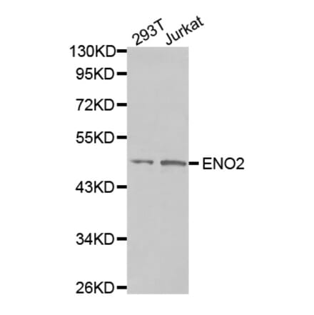 Anti-NSE/Enolase Antibody from Bioworld Technology (BS7180) - Antibodies.com