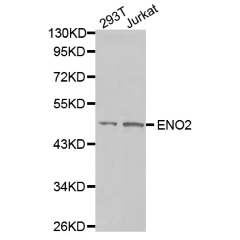 Anti-NSE/Enolase Antibody from Bioworld Technology (BS7180) - Antibodies.com