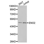 Anti-NSE/Enolase Antibody from Bioworld Technology (BS7180) - Antibodies.com