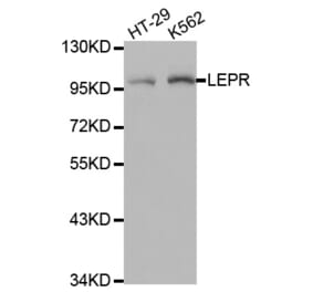 Anti-Ob-R Antibody from Bioworld Technology (BS7184) - Antibodies.com