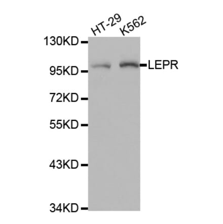 Anti-Ob-R Antibody from Bioworld Technology (BS7184) - Antibodies.com