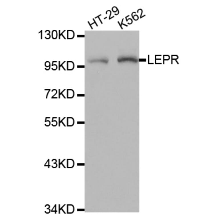 Anti-Ob-R Antibody from Bioworld Technology (BS7184) - Antibodies.com