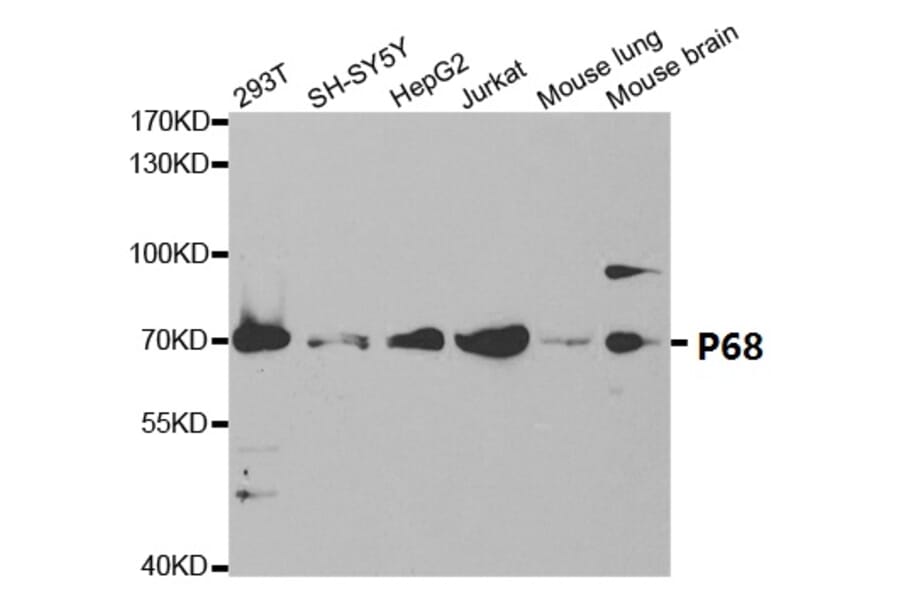 Anti-p68 RNA Helicase Antibody from Bioworld Technology (BS7186) - Antibodies.com