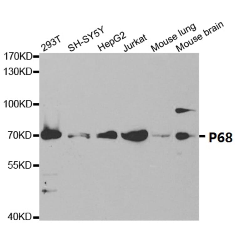 Anti-p68 RNA Helicase Antibody from Bioworld Technology (BS7186) - Antibodies.com