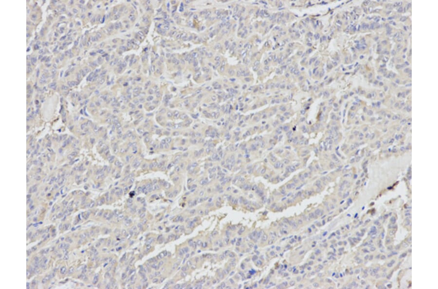 Anti-p68 RNA Helicase Antibody from Bioworld Technology (BS7186) - Antibodies.com