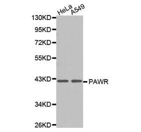 Anti-PAR4 Antibody from Bioworld Technology (BS7189) - Antibodies.com