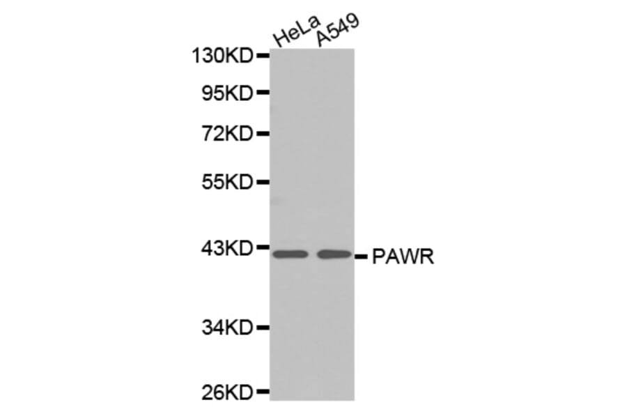Anti-PAR4 Antibody from Bioworld Technology (BS7189) - Antibodies.com