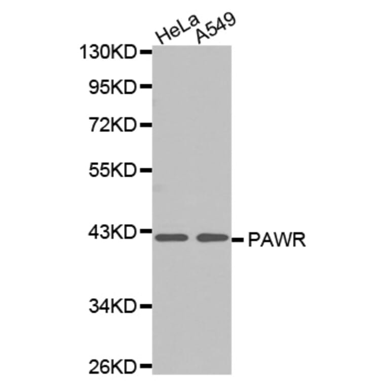 Anti-PAR4 Antibody from Bioworld Technology (BS7189) - Antibodies.com