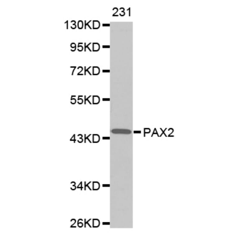 Anti-Pax-2 Antibody from Bioworld Technology (BS7191) - Antibodies.com