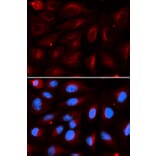 Anti-PIASx Antibody from Bioworld Technology (BS7196) - Antibodies.com