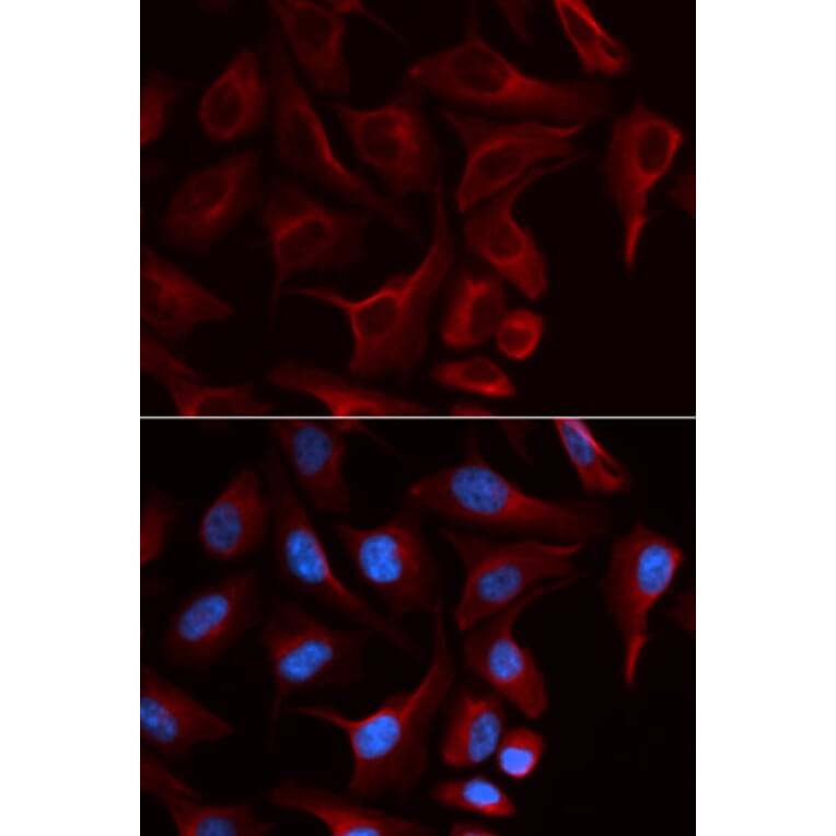 Anti-Plakophilin 2 Antibody from Bioworld Technology (BS7197) - Antibodies.com