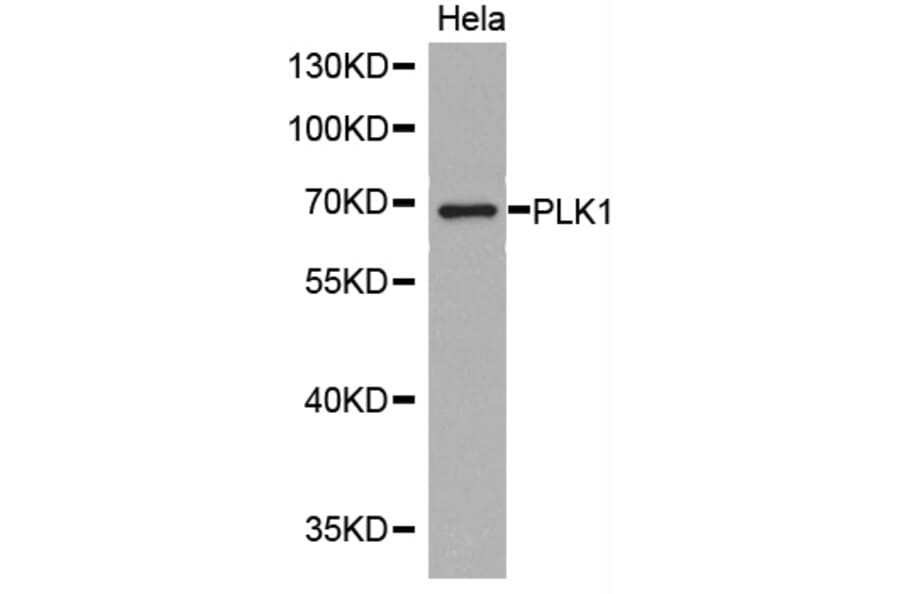 Anti-PLK1 Antibody from Bioworld Technology (BS7198) - Antibodies.com