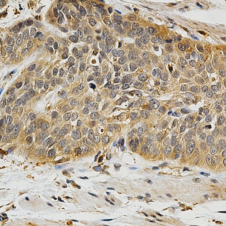 Anti-PLK1 Antibody from Bioworld Technology (BS7198) - Antibodies.com
