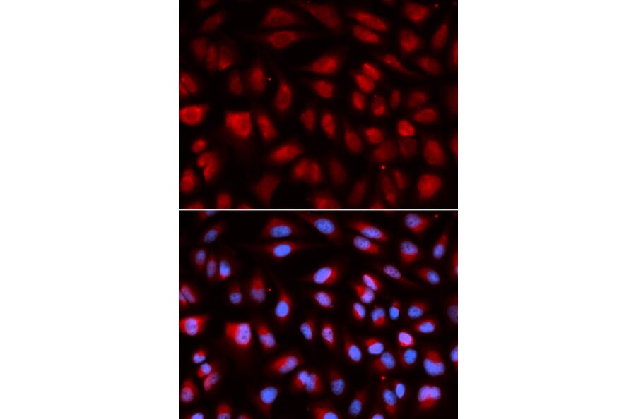 Anti-PLK1 Antibody from Bioworld Technology (BS7198) - Antibodies.com