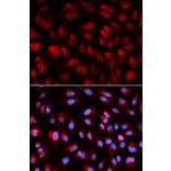 Anti-PLK1 Antibody from Bioworld Technology (BS7198) - Antibodies.com