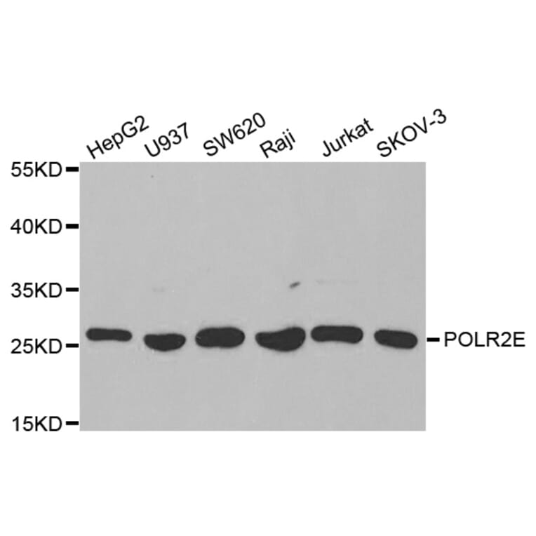 Anti-POLR2E Antibody from Bioworld Technology (BS7199) - Antibodies.com