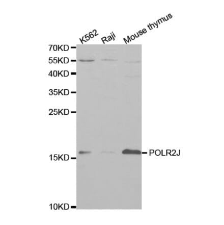 Anti-POLR2J1 Antibody from Bioworld Technology (BS7200) - Antibodies.com