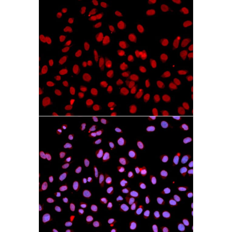 Anti-POLR2J1 Antibody from Bioworld Technology (BS7200) - Antibodies.com