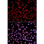 Anti-POLR2J1 Antibody from Bioworld Technology (BS7200) - Antibodies.com