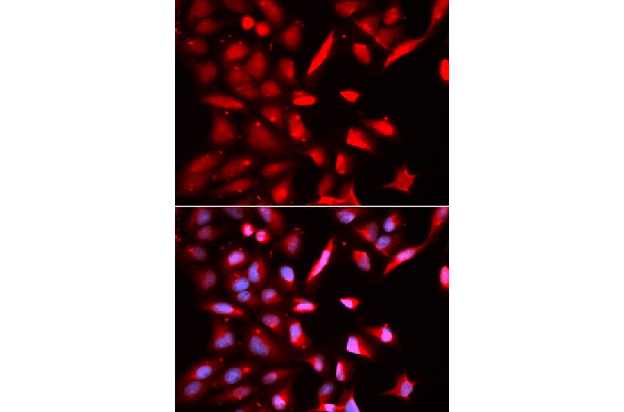 Anti-PSMC3 Antibody from Bioworld Technology (BS7204) - Antibodies.com