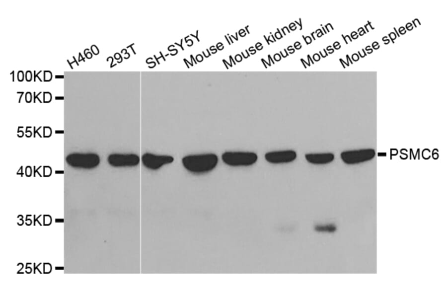 Anti-PSMC6 Antibody from Bioworld Technology (BS7205) - Antibodies.com