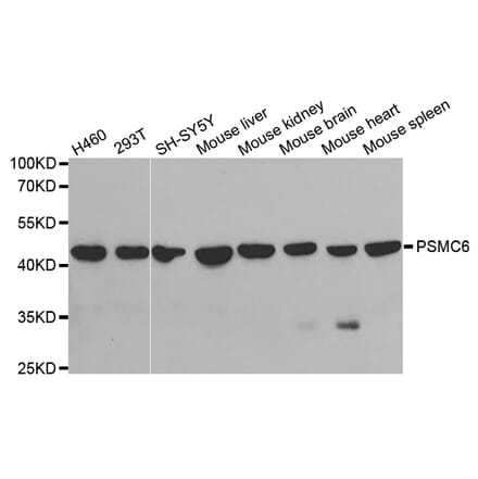 Anti-PSMC6 Antibody from Bioworld Technology (BS7205) - Antibodies.com