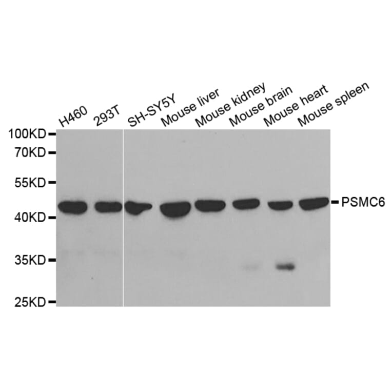Anti-PSMC6 Antibody from Bioworld Technology (BS7205) - Antibodies.com