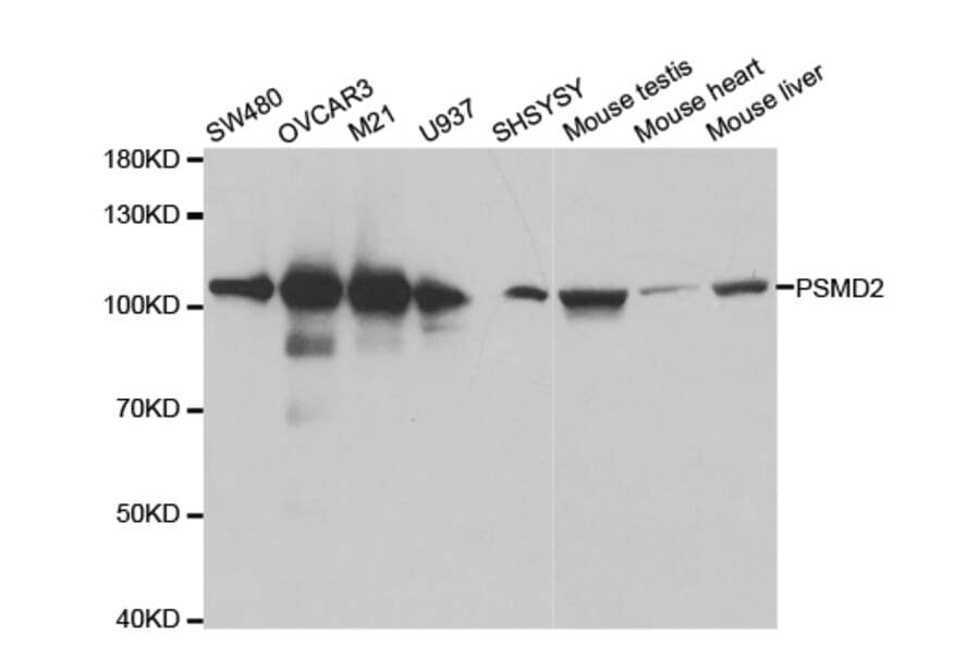 Anti-PSMD2 Antibody from Bioworld Technology (BS7206) - Antibodies.com