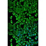 Anti-PSMD2 Antibody from Bioworld Technology (BS7206) - Antibodies.com