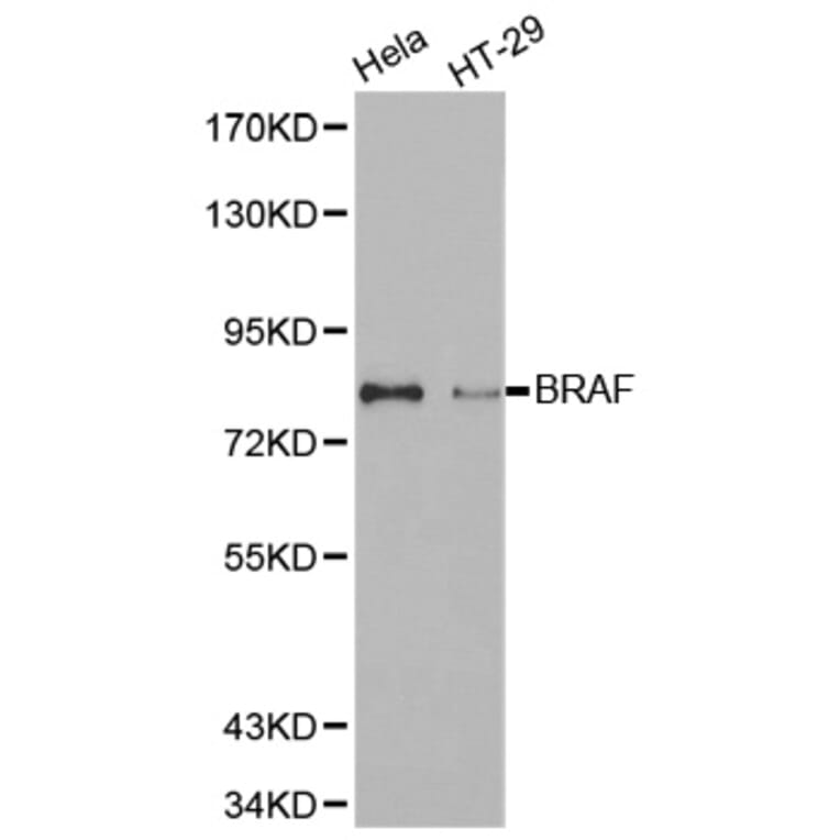 Anti-Raf-B Antibody from Bioworld Technology (BS7213) - Antibodies.com