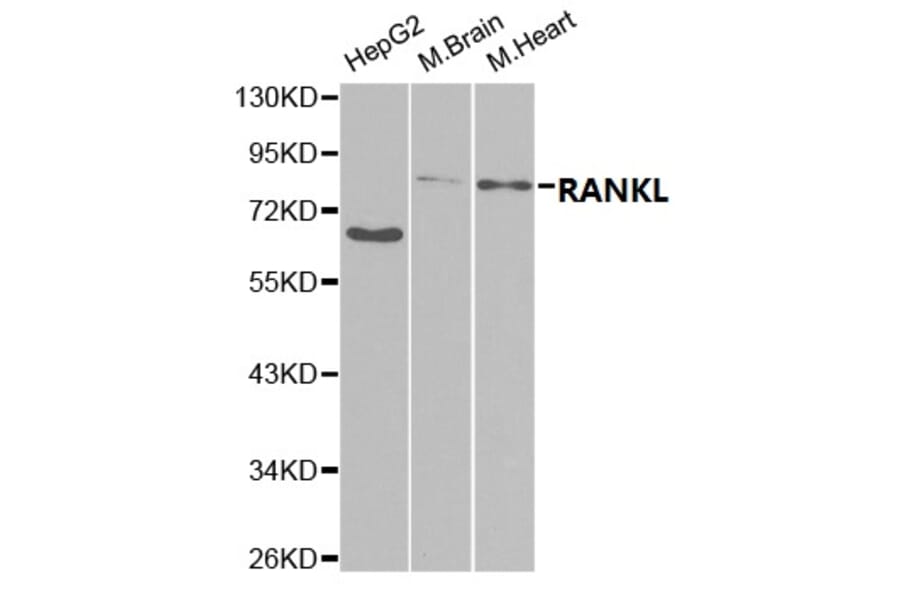 Anti-RANKL Antibody from Bioworld Technology (BS7214) - Antibodies.com