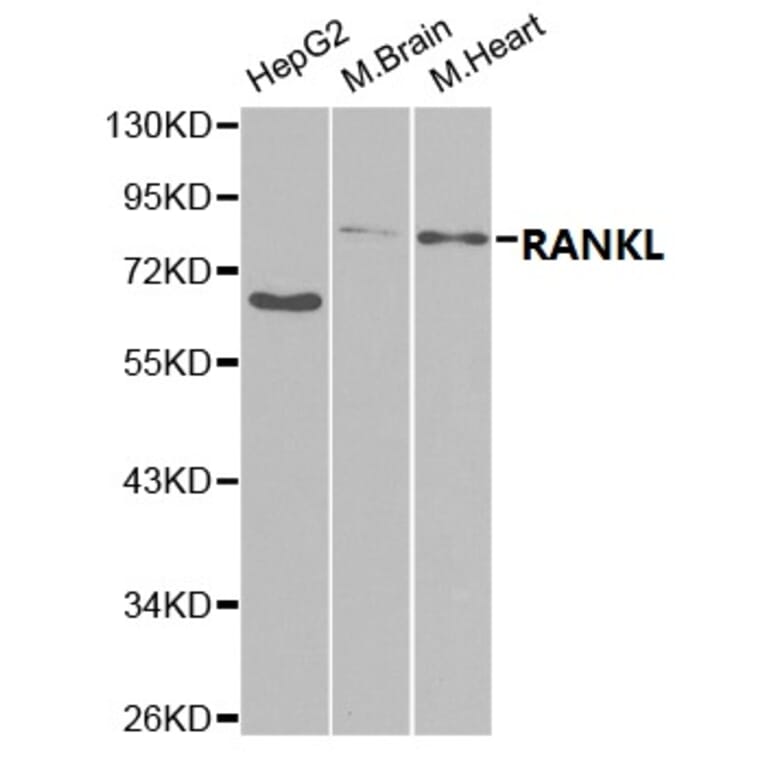 Anti-RANKL Antibody from Bioworld Technology (BS7214) - Antibodies.com