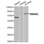 Anti-RANKL Antibody from Bioworld Technology (BS7214) - Antibodies.com