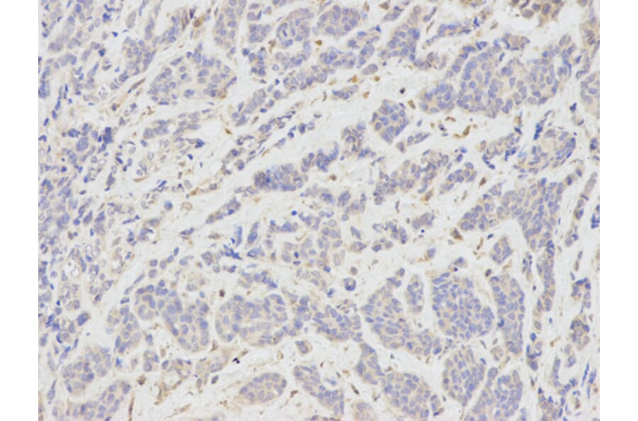 Anti-RANKL Antibody from Bioworld Technology (BS7214) - Antibodies.com