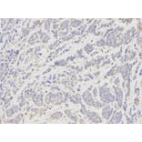 Anti-RANKL Antibody from Bioworld Technology (BS7214) - Antibodies.com
