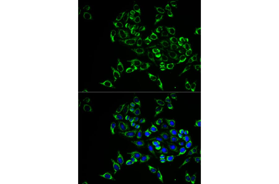 Anti-RANKL Antibody from Bioworld Technology (BS7214) - Antibodies.com