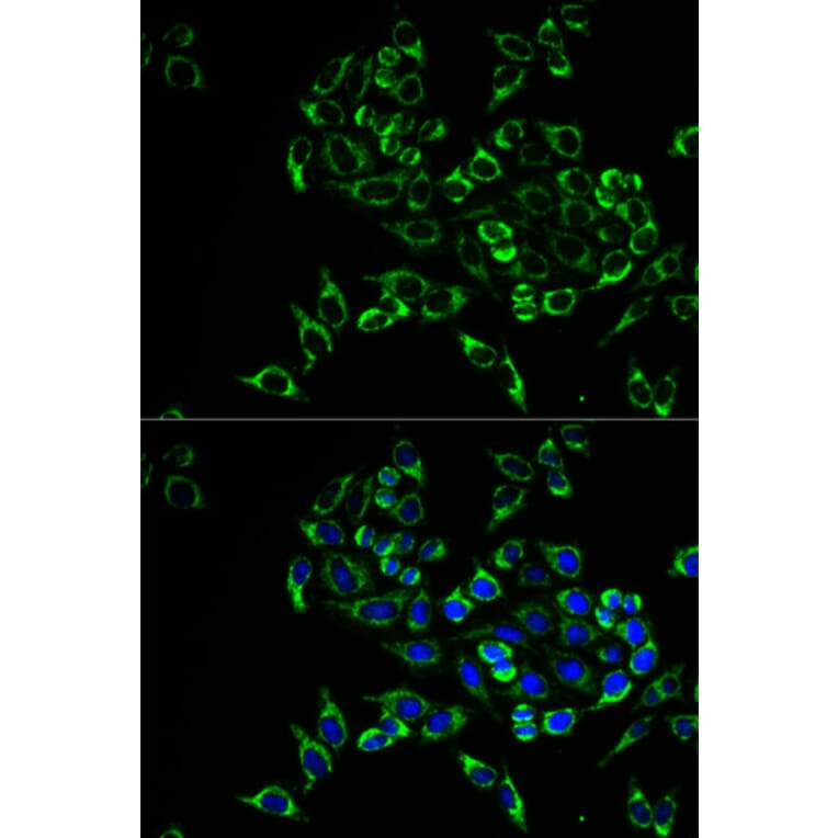 Anti-RANKL Antibody from Bioworld Technology (BS7214) - Antibodies.com