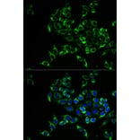 Anti-RANKL Antibody from Bioworld Technology (BS7214) - Antibodies.com