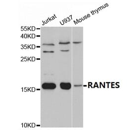 Anti-RANTES Antibody from Bioworld Technology (BS7215) - Antibodies.com