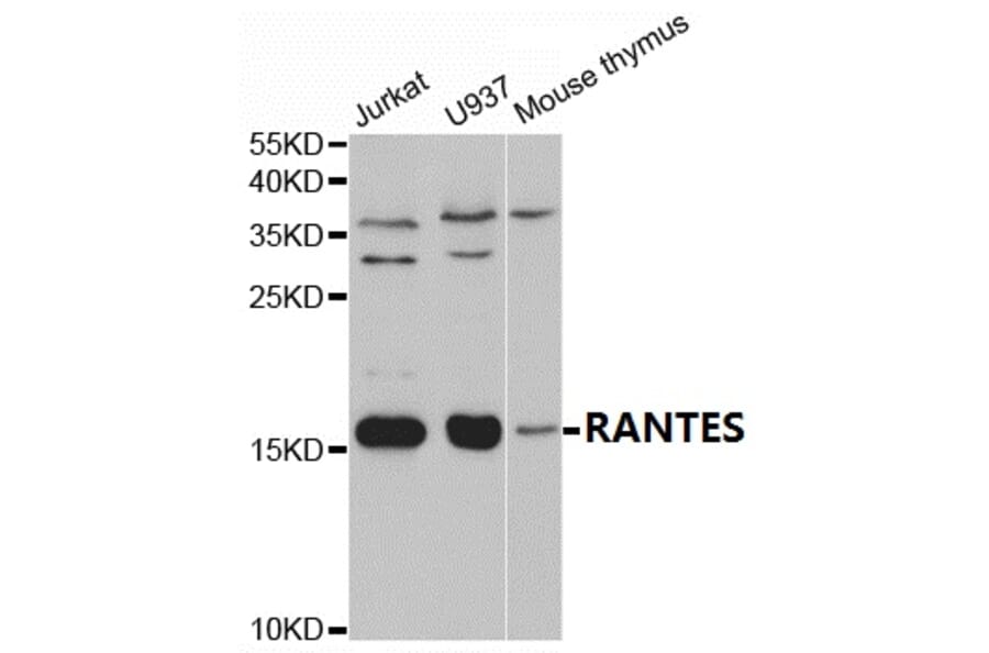 Anti-RANTES Antibody from Bioworld Technology (BS7215) - Antibodies.com