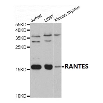 Anti-RANTES Antibody from Bioworld Technology (BS7215) - Antibodies.com