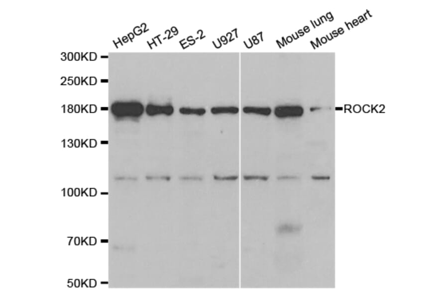 Anti-Rock-2 Antibody from Bioworld Technology (BS7216) - Antibodies.com