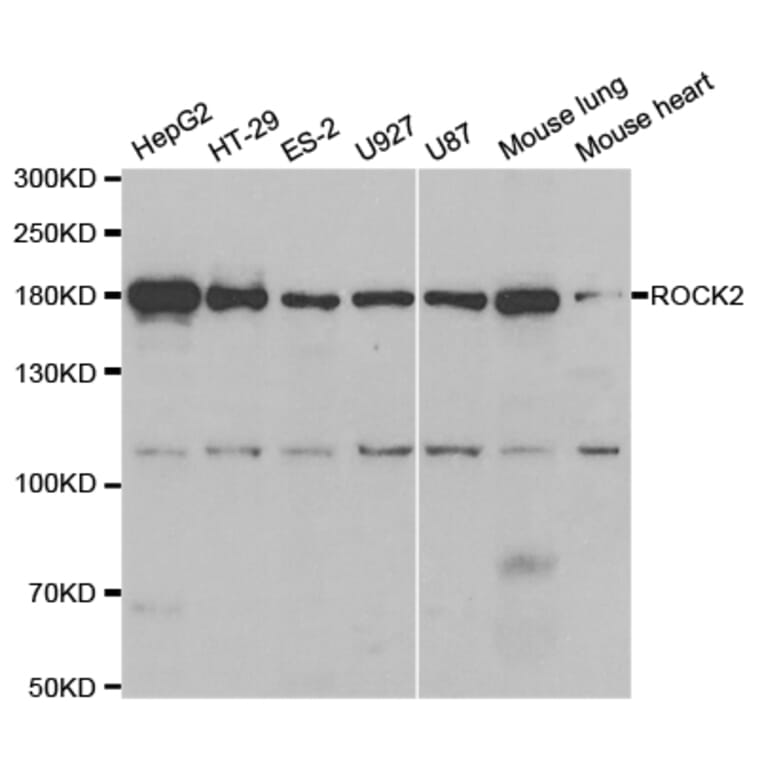 Anti-Rock-2 Antibody from Bioworld Technology (BS7216) - Antibodies.com
