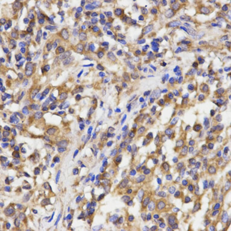 Anti-RPL5 Antibody from Bioworld Technology (BS7217) - Antibodies.com