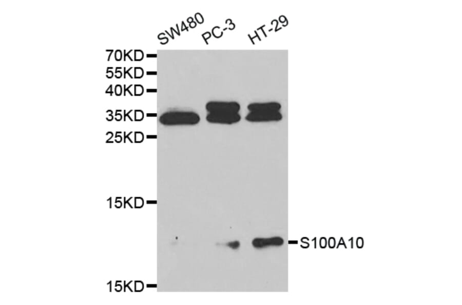 Anti-S100A10 Antibody from Bioworld Technology (BS7218) - Antibodies.com