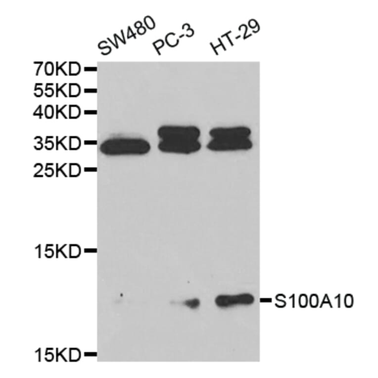 Anti-S100A10 Antibody from Bioworld Technology (BS7218) - Antibodies.com