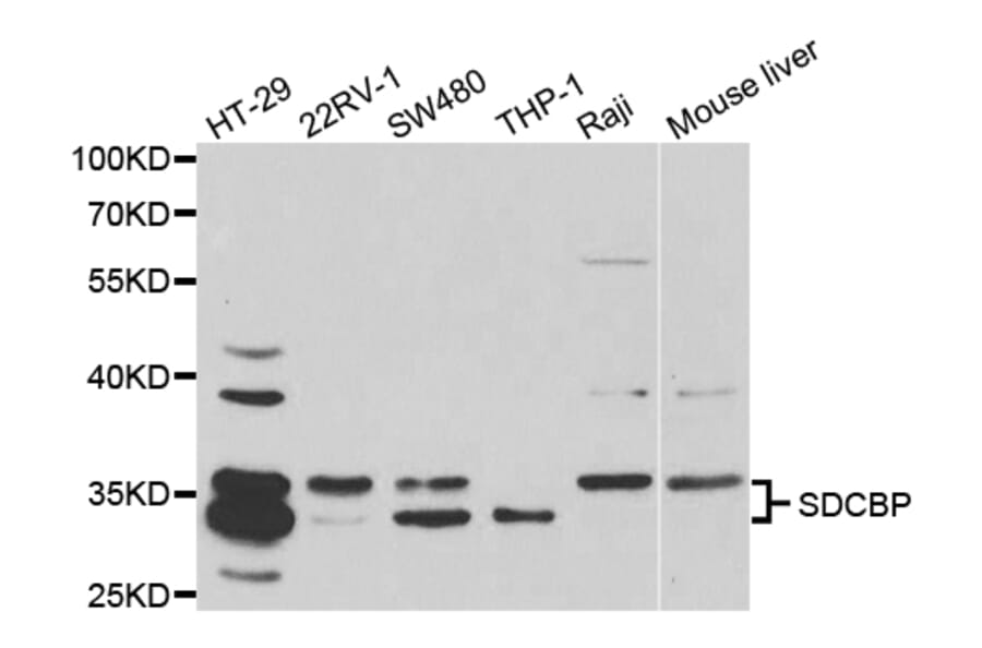 Anti-SDCBP Antibody from Bioworld Technology (BS7219) - Antibodies.com