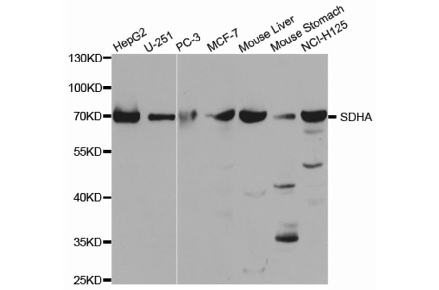Anti-SDHA Antibody from Bioworld Technology (BS7220) - Antibodies.com
