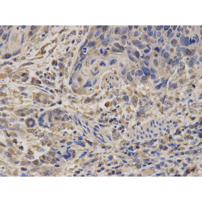Anti-SDHA Antibody from Bioworld Technology (BS7220) - Antibodies.com
